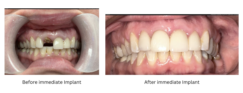 AAID Blog before and after