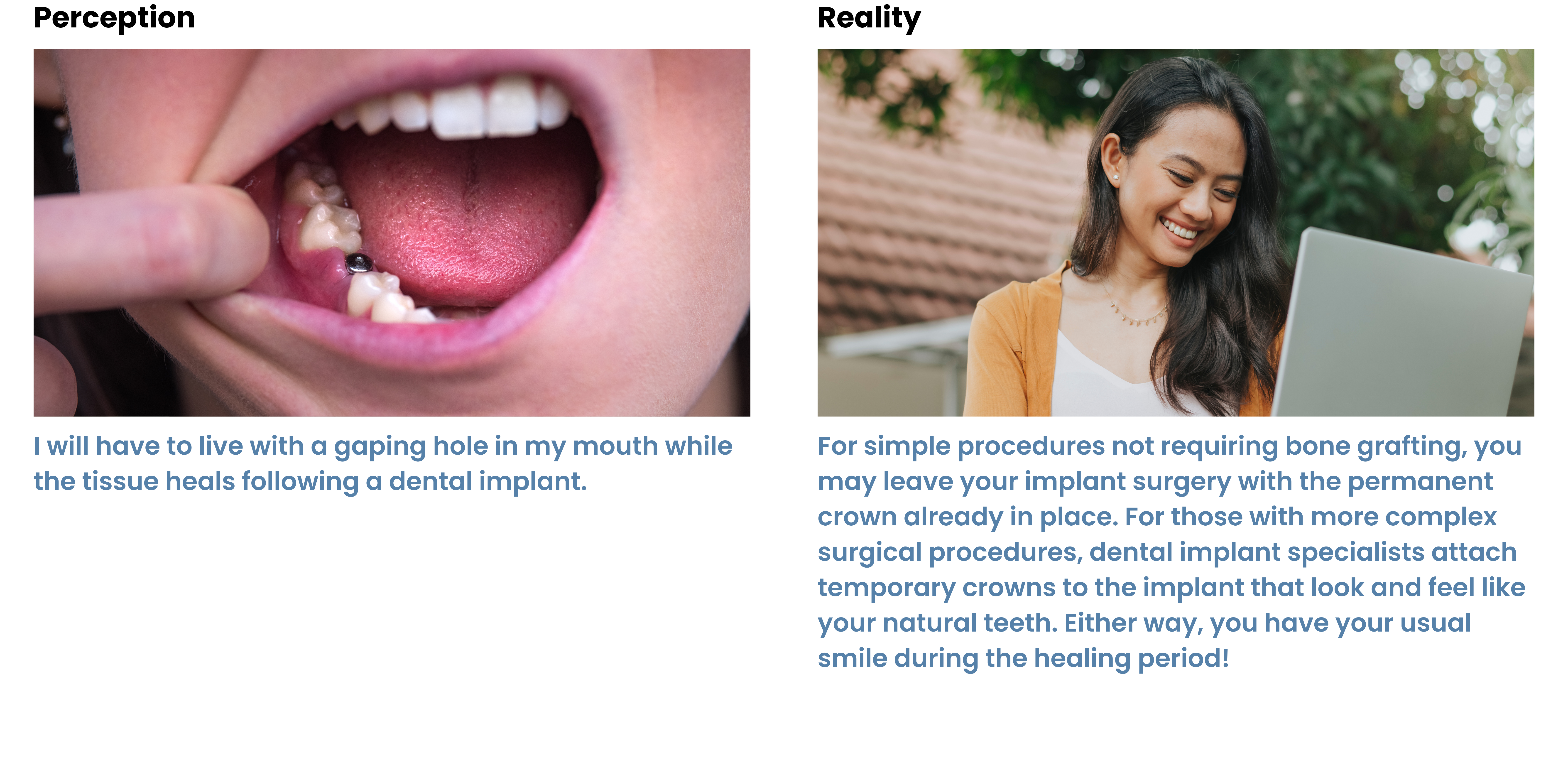 Girl with dental implant hole showing compared side by side to a smiling woman with good teeth