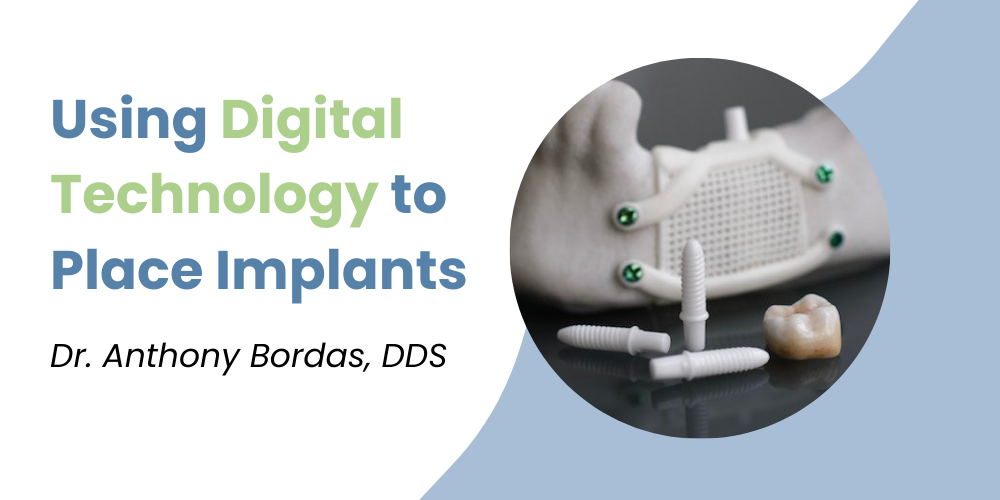 Image of the blog's title, "Using Digital Technology to Place Implants," the author's name, and dental implants.