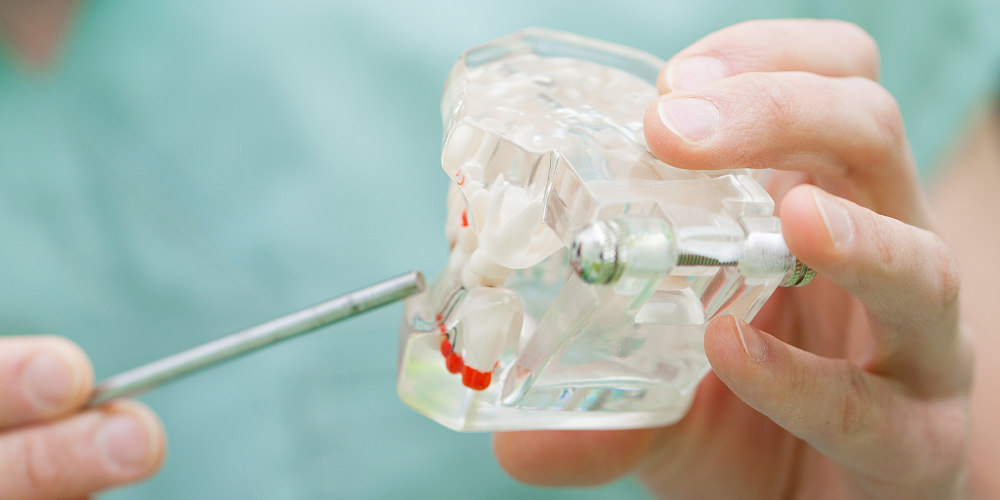 Dentist holding a model of human teeth