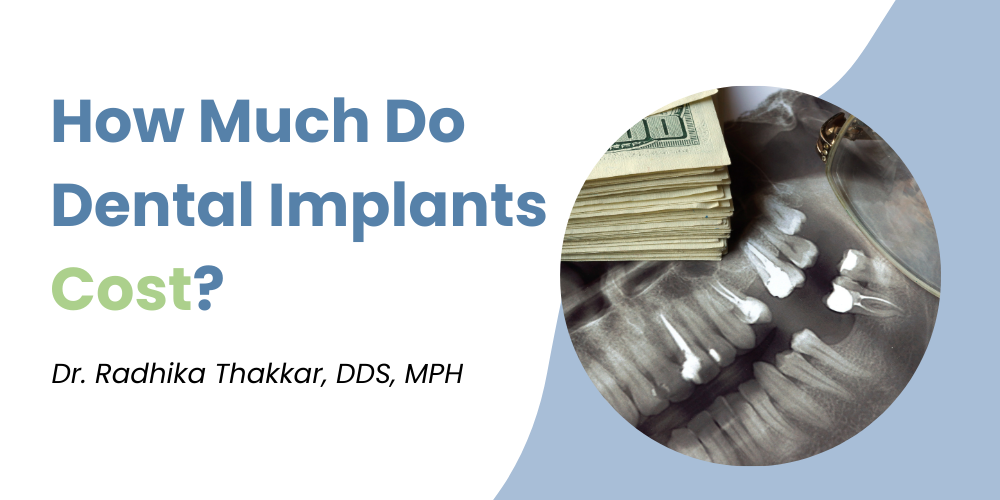 Graphic with the blog title, "How Much Do Dental Implants Cost?"
