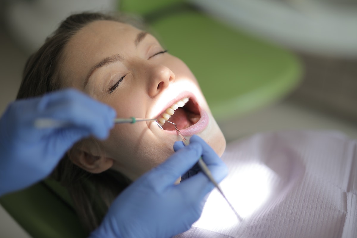 How Long Do Dental Implants Last? 