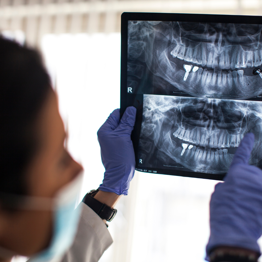 Image of a dentist looking at an x-ray of the mouth